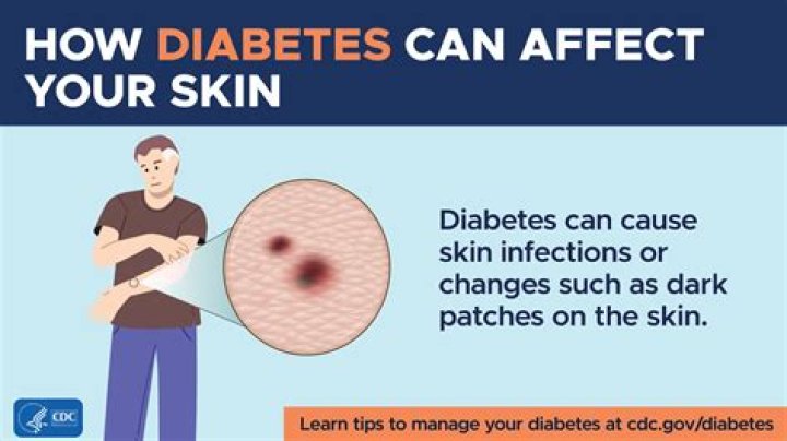 Can diabetes give you a bad taste in your mouth?