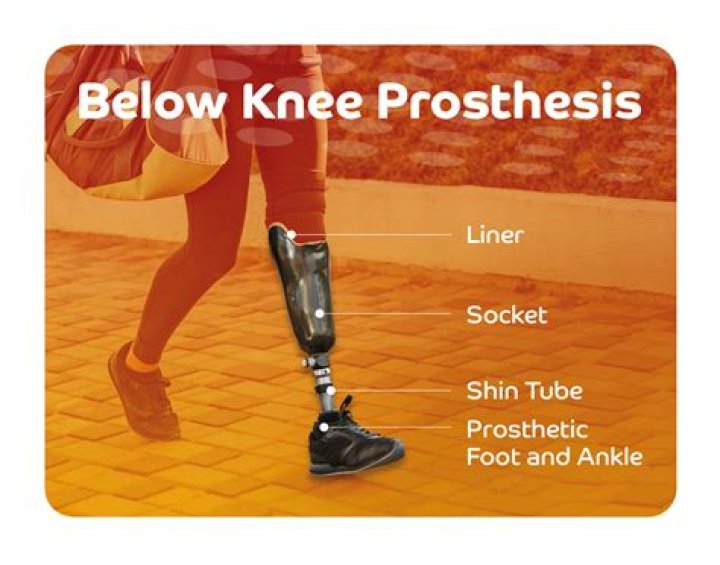 Can you wear a prosthetic leg in the ocean?