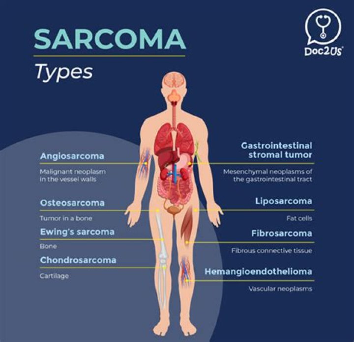 Does sarcoma mean cancer