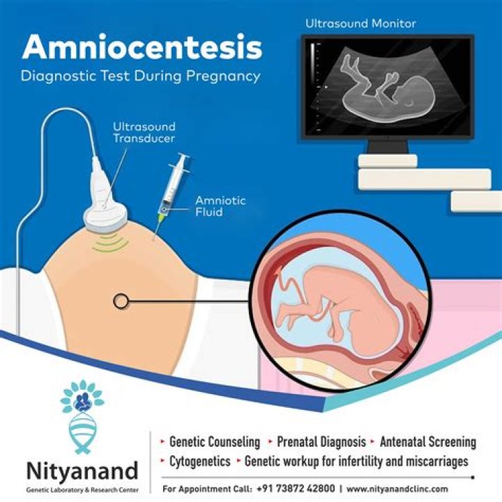 How is an amniocentesis done