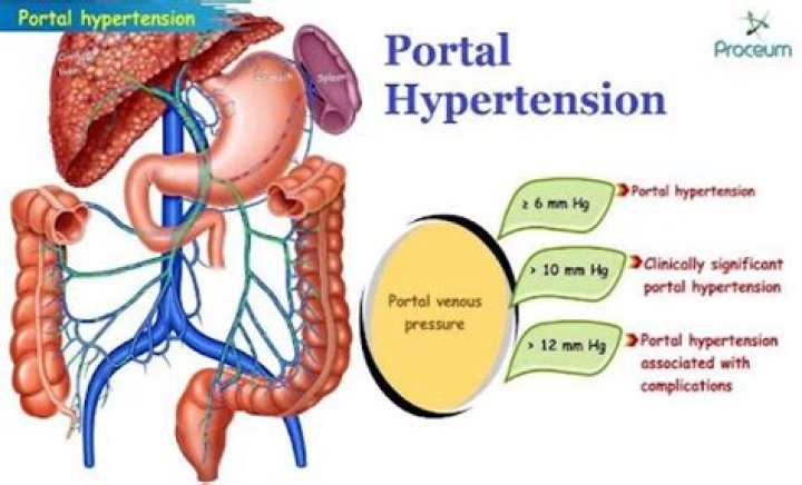 How is cirrhosis related to portal hypertension?