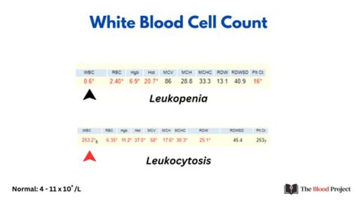 Is a white blood cell count of 11.8 high?