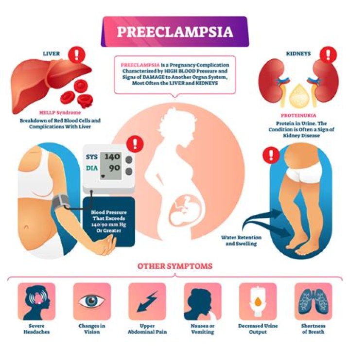 Is eclampsia still fatal?