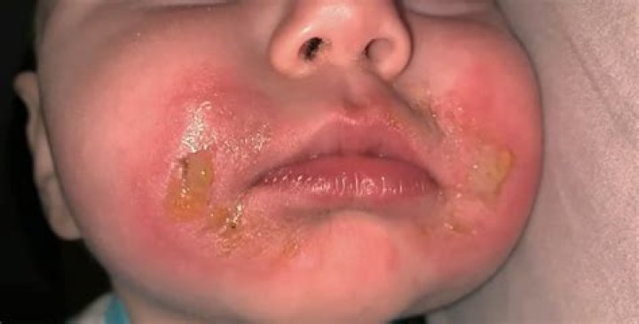 What does it mean burn baby burn?