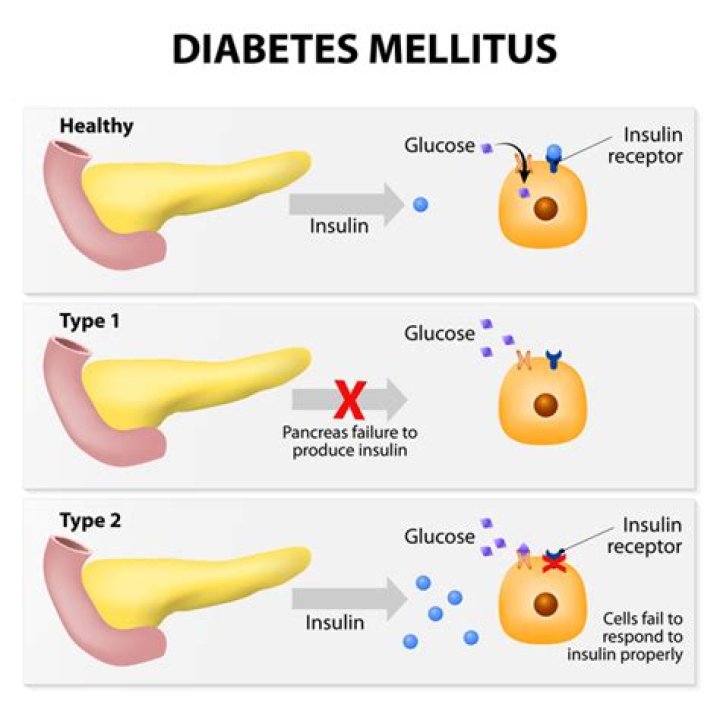 What happens in type 2 diabetes mellitus