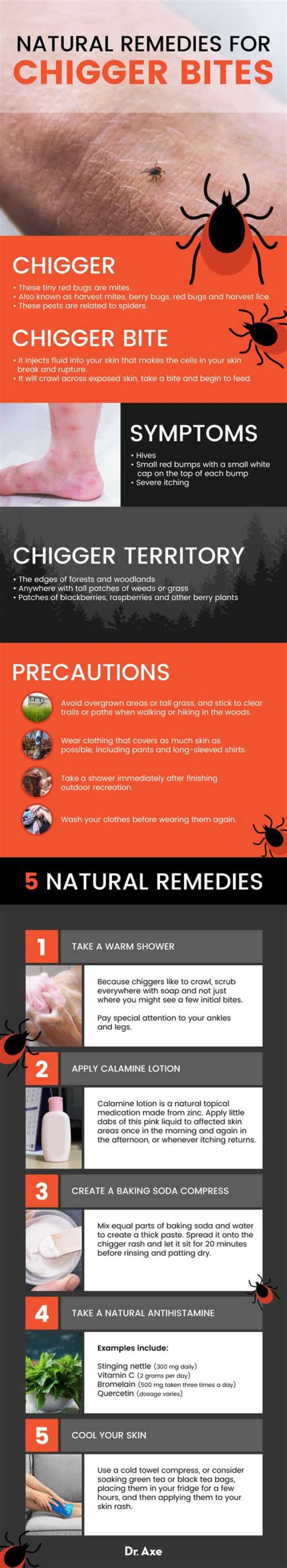 What is a natural remedy for chigger bites