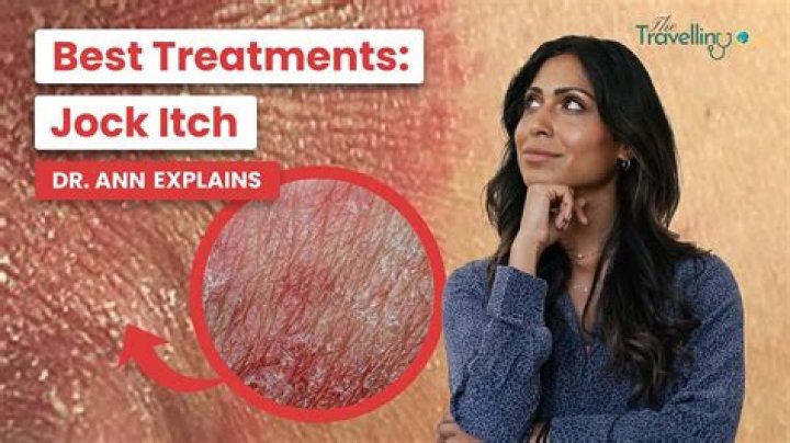 What is jock itch vs yeast infection?