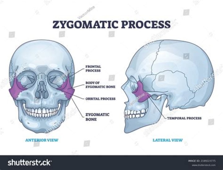 Where is the zygomatic bone found in the human body