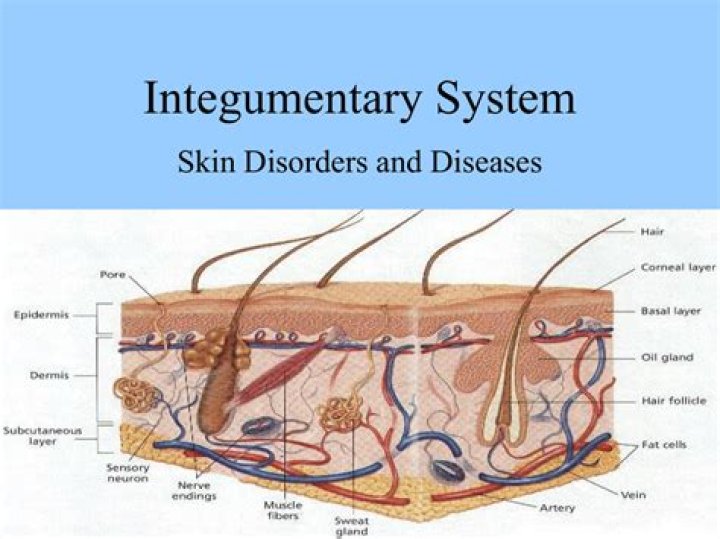 Which disease primarily affects integumentary system