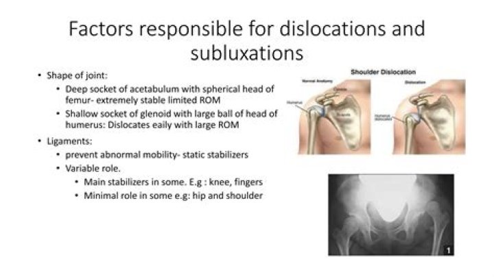 Which joint is most frequently involved with subluxations and/or dislocations?