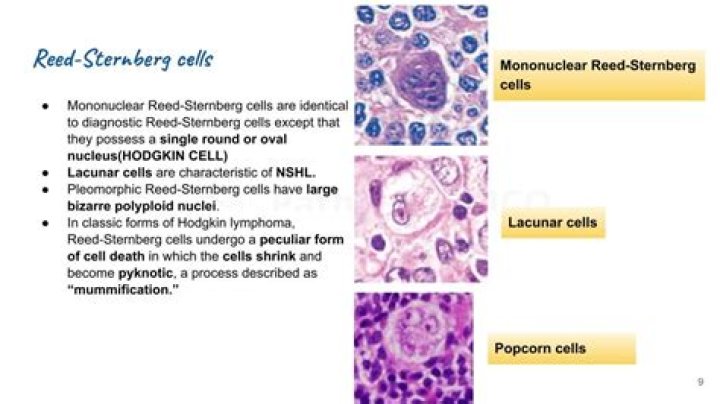 Which type of malignancy would you see Reed Sternberg cells present